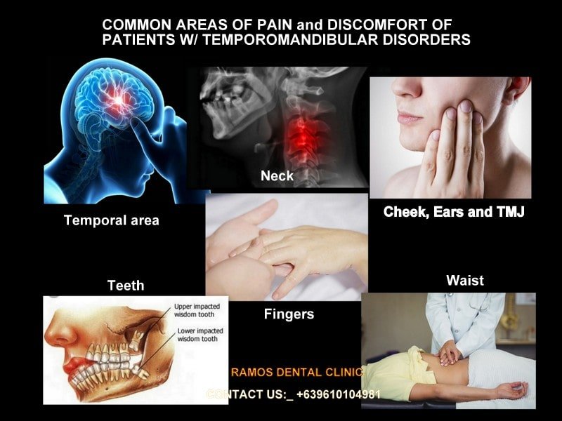 Locations Of Pain & Discomfort Of TMD Patients